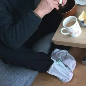 His plastic bag solution for imaginary red bumps. | Living with and caring for someone with Alzheimer's at marcikobayashi.com